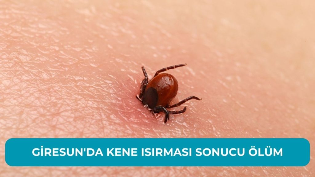 Giresun’da Kene Isırması Sonucu Ölüm