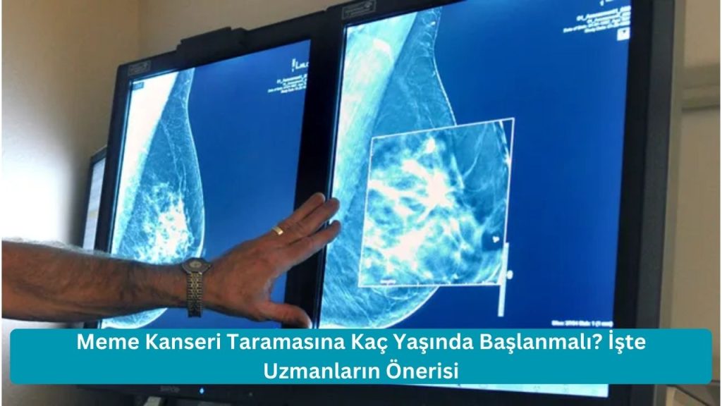 Meme Kanseri Taramasına Kaç Yaşında Başlanmalı? İşte Uzmanların Önerisi